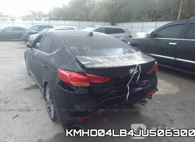 KMHD04LB4JU506300 фото 7