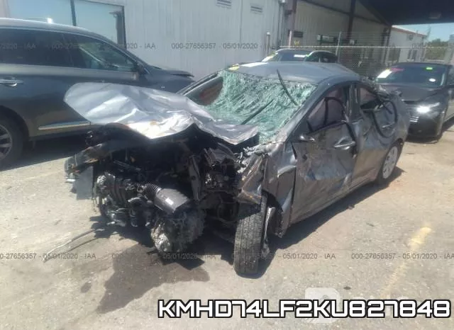 KMHD74LF2KU827848 фото 7