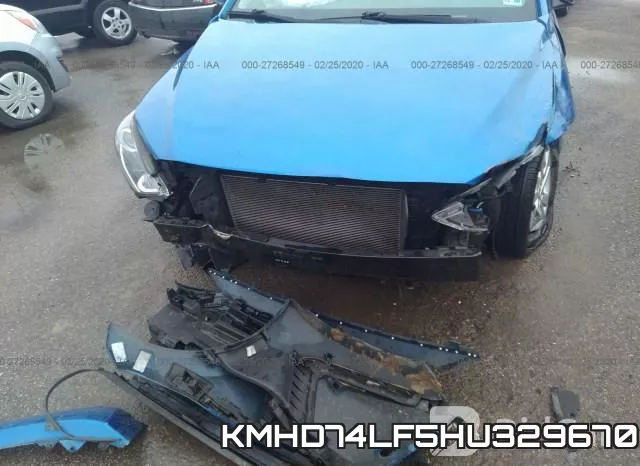 KMHD74LF5HU329670 фото 7