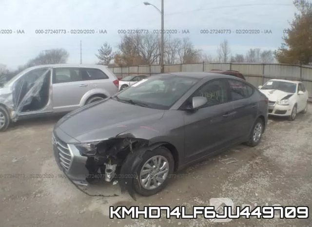 KMHD74LF6JU449709 фото 3