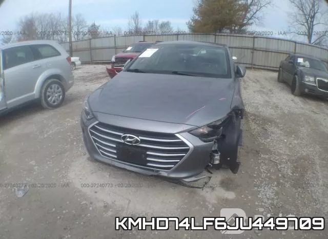 KMHD74LF6JU449709 фото 7