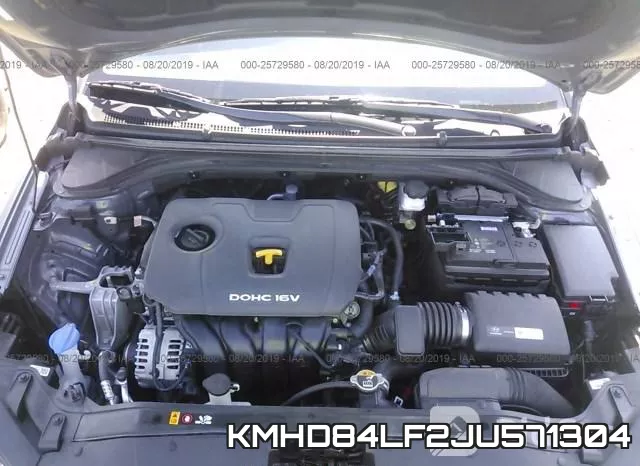 KMHD84LF2JU571304 фото 2