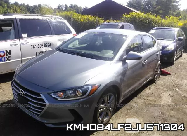KMHD84LF2JU571304 фото 3