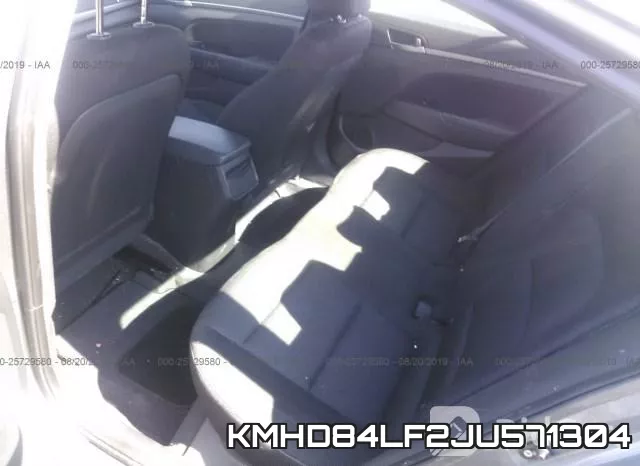 KMHD84LF2JU571304 фото 9