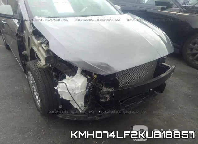KMHD74LF2KU818857 фото 7