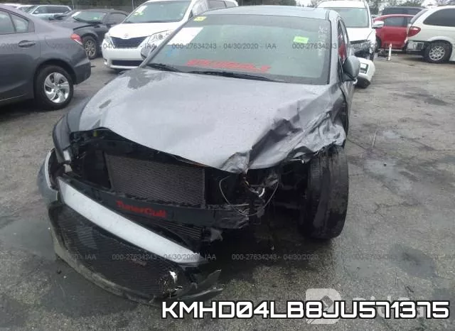 KMHD04LB8JU571375 фото 7