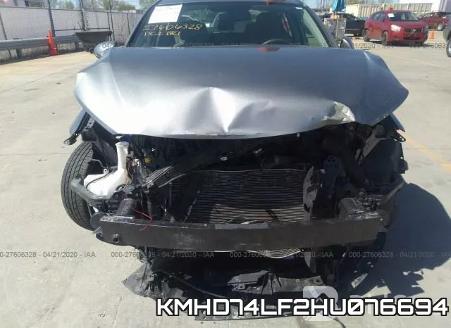 KMHD74LF2HU076694 фото 7