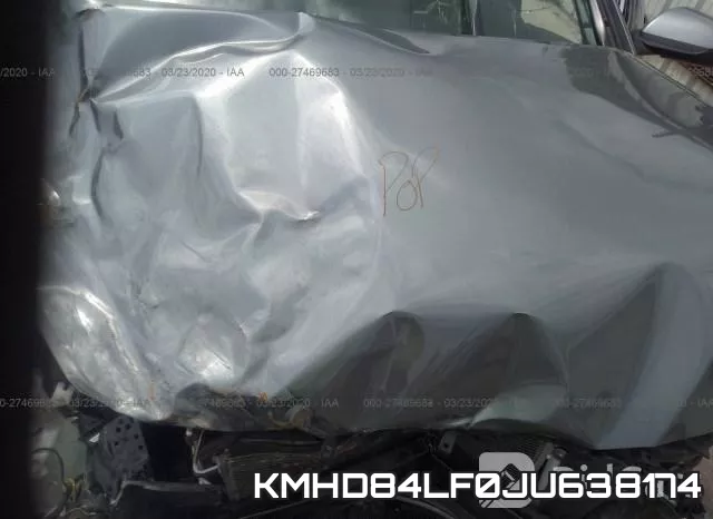 KMHD84LF0JU638174 фото 2
