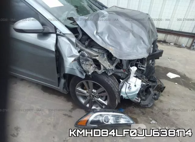 KMHD84LF0JU638174 фото 7