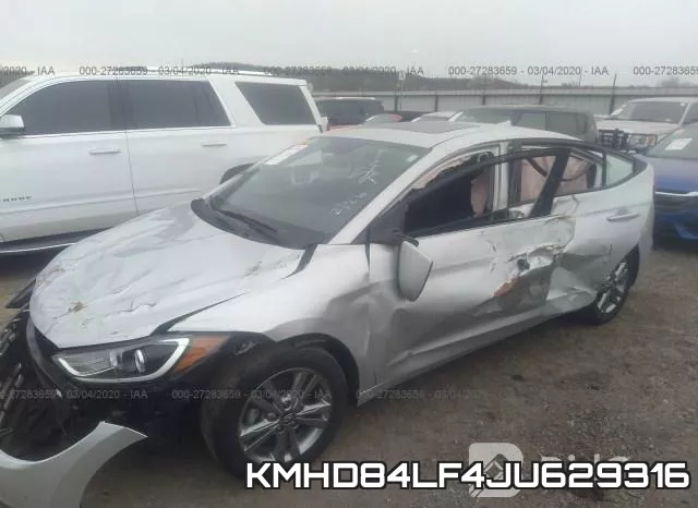 KMHD84LF4JU629316 фото 3