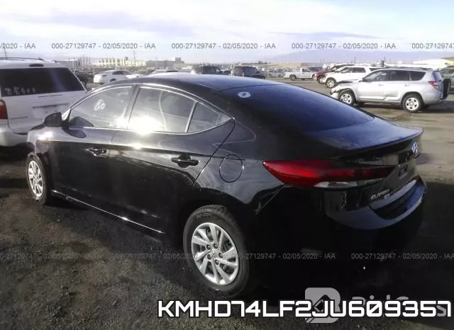 KMHD74LF2JU609357 фото 4
