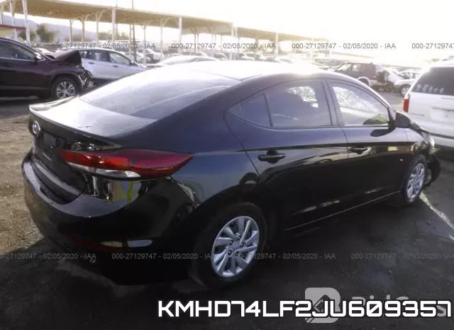 KMHD74LF2JU609357 фото 5