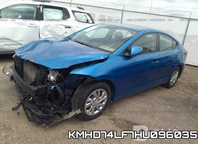 KMHD74LF7HU096035 фото 3