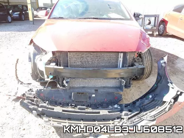 KMHD04LB3JU608512 фото 10
