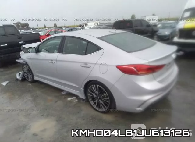 KMHD04LB1JU613126 фото 4