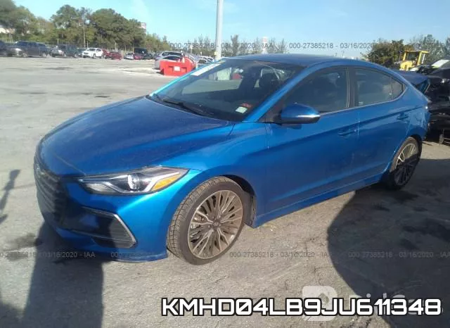 KMHD04LB9JU611348 фото 3