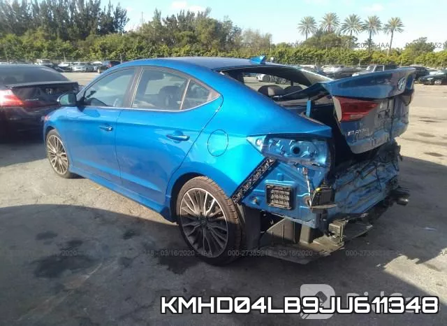 KMHD04LB9JU611348 фото 4