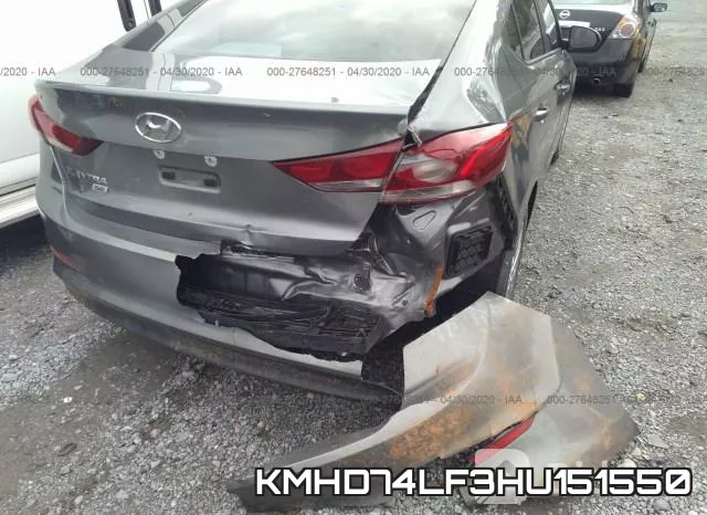 KMHD74LF3HU151550 фото 7