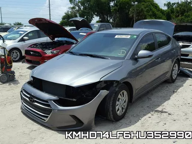 KMHD74LF6HU352990 фото 3