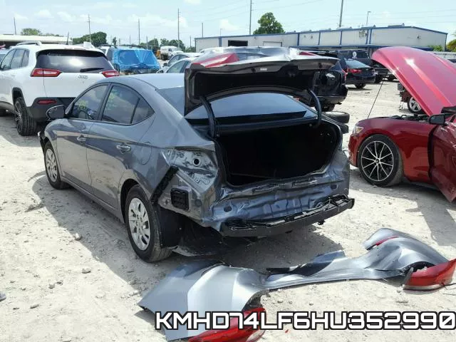 KMHD74LF6HU352990 фото 4