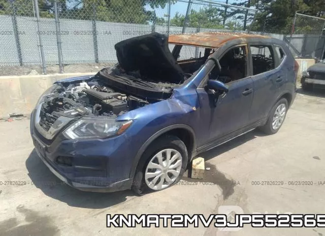 KNMAT2MV3JP552565 фото 3
