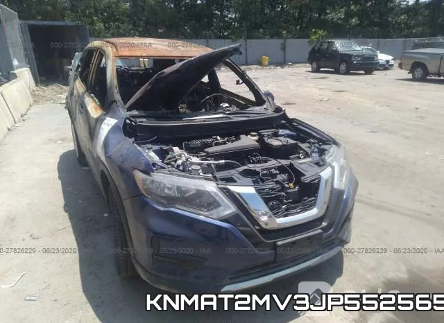 KNMAT2MV3JP552565 фото 7