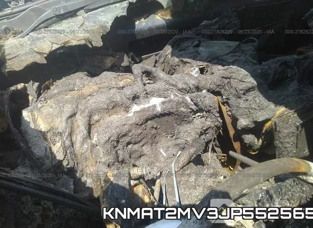 KNMAT2MV3JP552565 фото 8