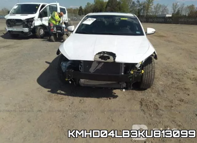KMHD04LB3KU813099 фото 7