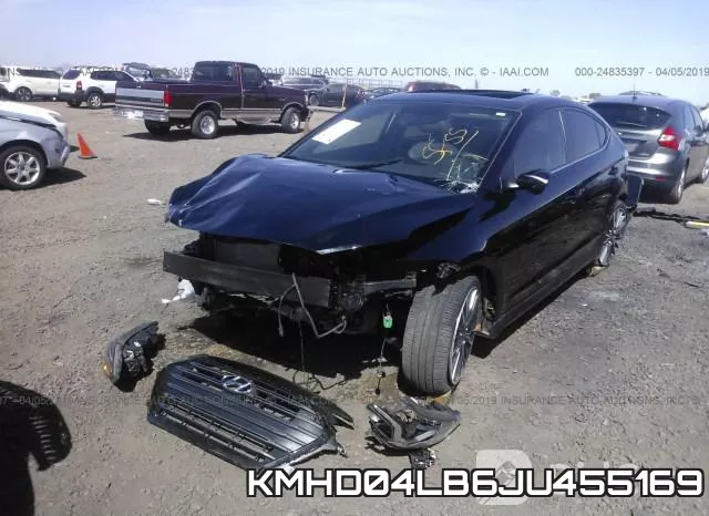 KMHD04LB6JU455169 фото 3