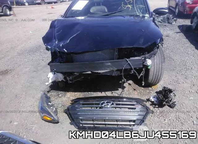 KMHD04LB6JU455169 фото 7
