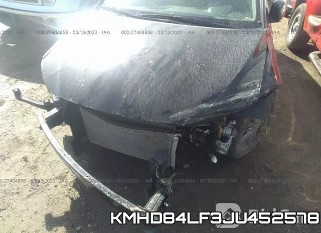 KMHD84LF3JU452578 фото 2