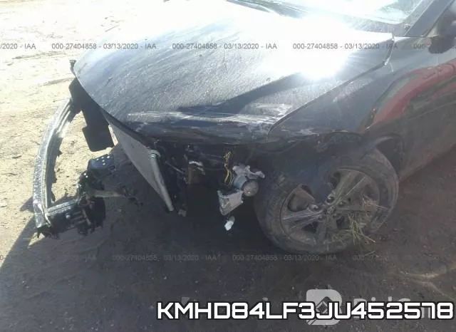 KMHD84LF3JU452578 фото 7