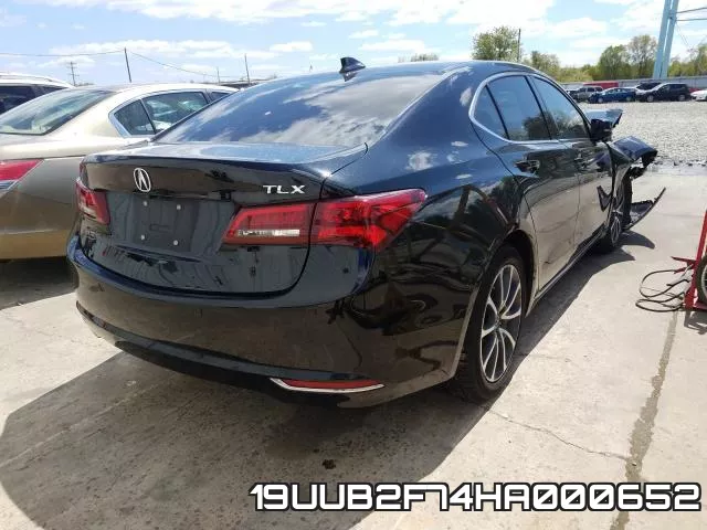 19UUB2F74HA000652 фото 5