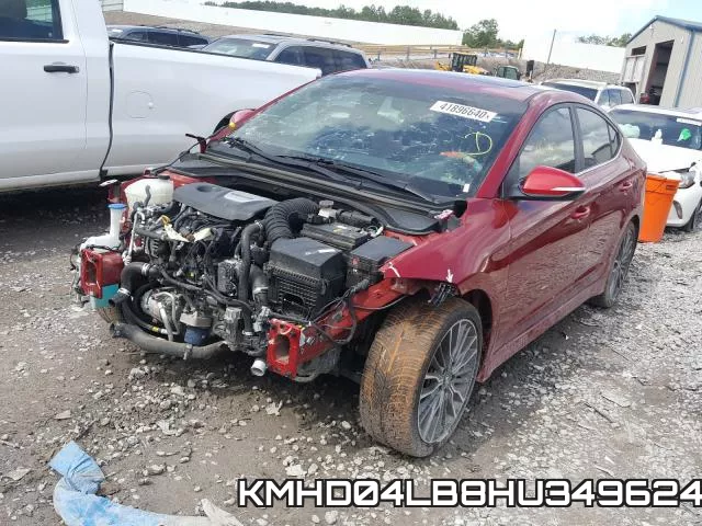 KMHD04LB8HU349624 фото 3