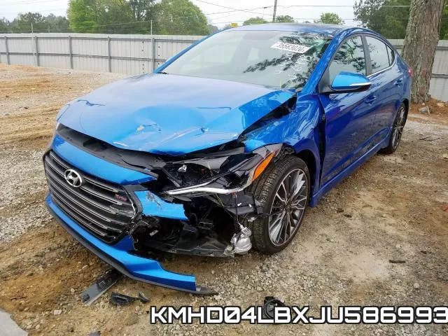 KMHD04LBXJU586993 фото 3