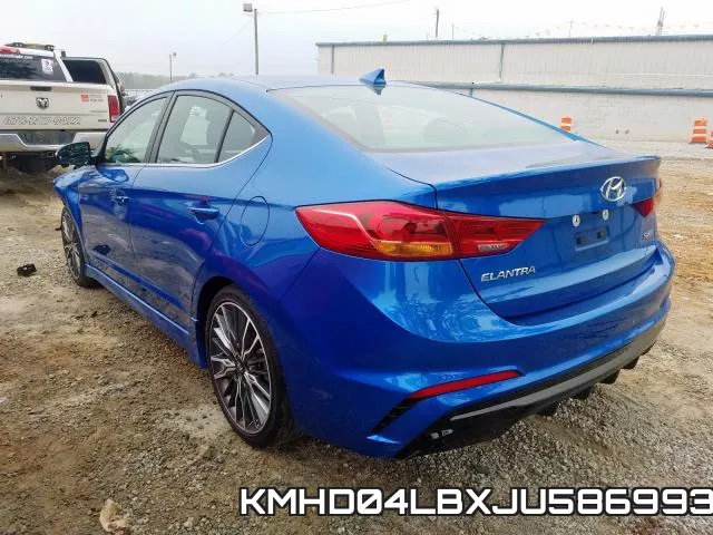 KMHD04LBXJU586993 фото 4