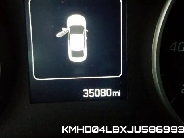 KMHD04LBXJU586993 фото 9