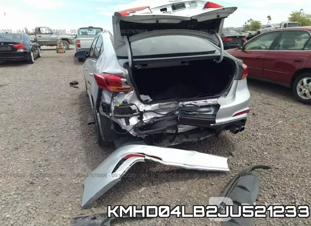 KMHD04LB2JU521233 фото 7