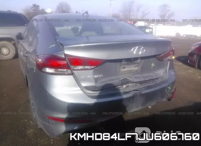 KMHD84LF7JU606760 фото 7