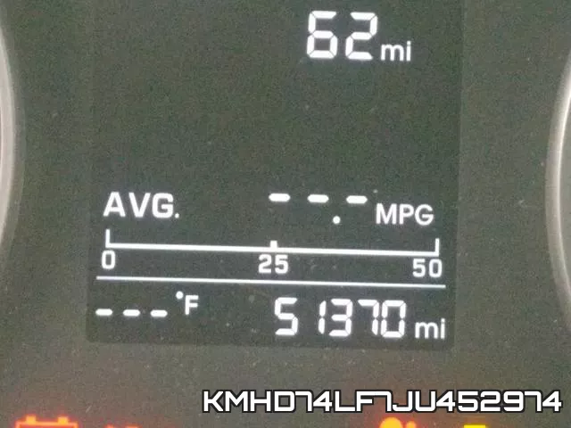 KMHD74LF7JU452974 фото 9