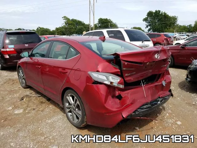 KMHD84LF6JU451831 фото 4