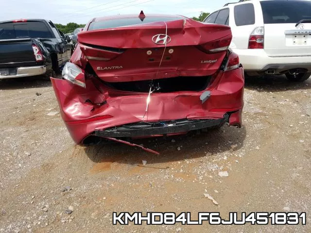 KMHD84LF6JU451831 фото 10