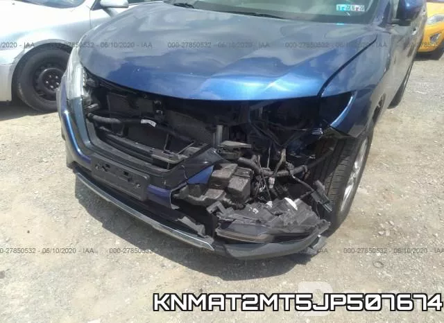 KNMAT2MT5JP507674 фото 7