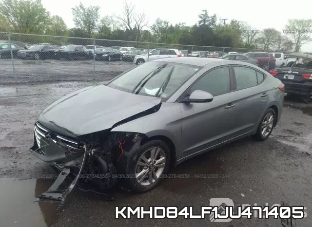 KMHD84LF1JU471405 фото 3