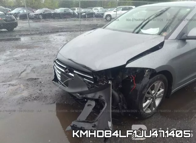 KMHD84LF1JU471405 фото 7