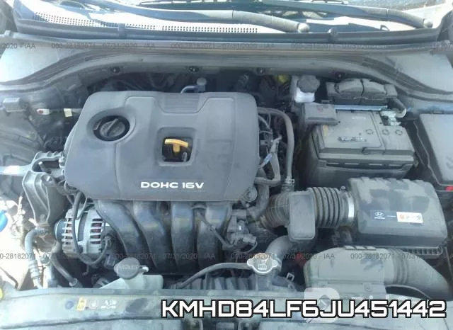 KMHD84LF6JU451442 фото 2