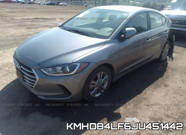 KMHD84LF6JU451442 фото 3