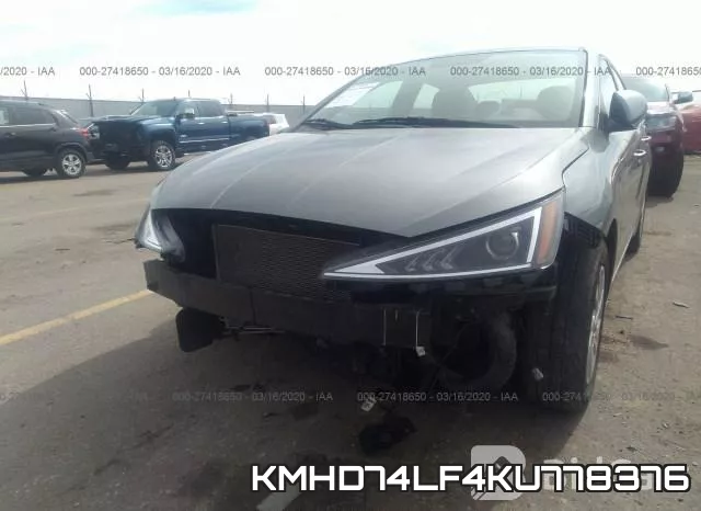 KMHD74LF4KU778376 фото 7