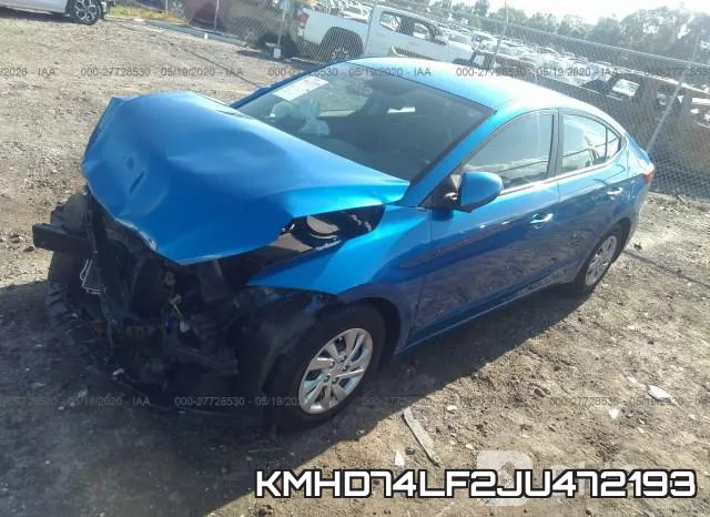 KMHD74LF2JU472193 фото 3