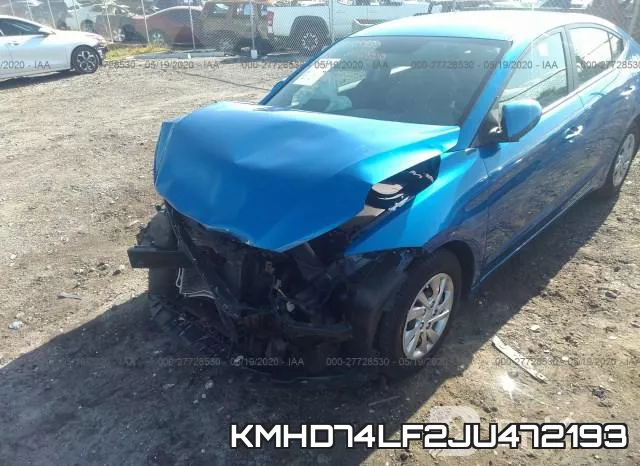 KMHD74LF2JU472193 фото 7